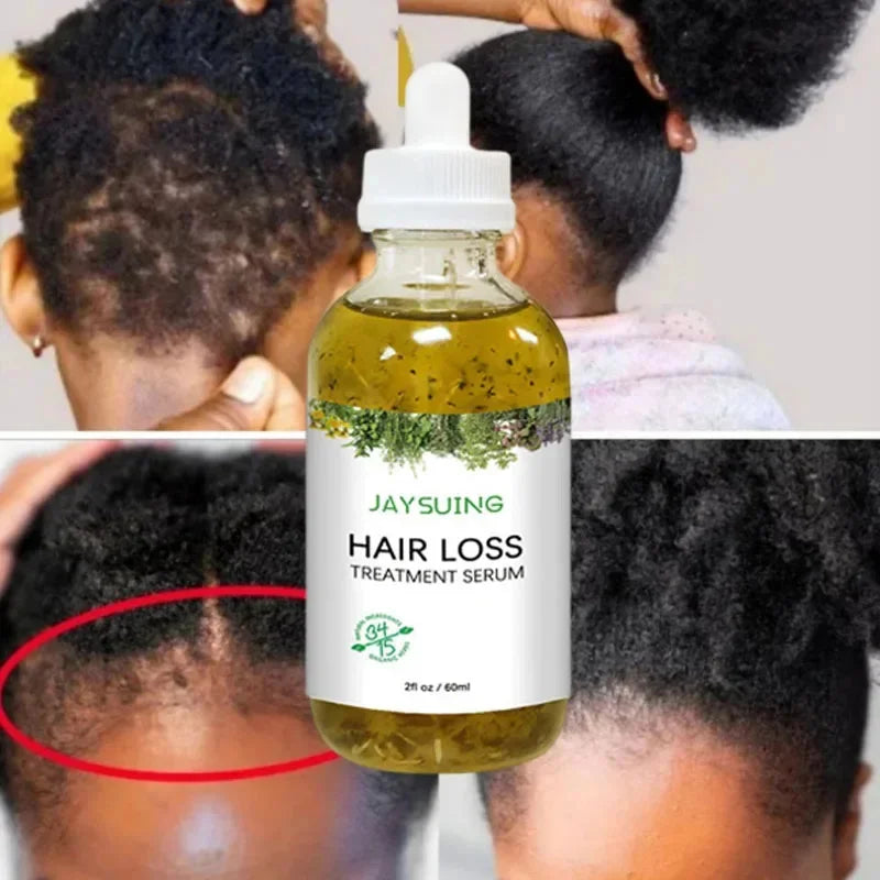 Rosemary Hair Growth Serum